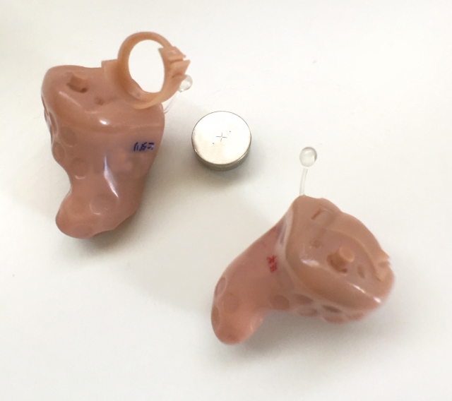 半年ぶりの定期健診で聴力低下。いよいよ・・・